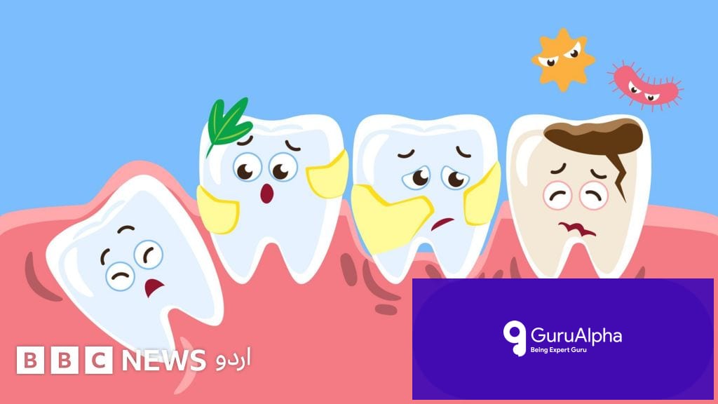 The Evolutionary Mismatch Behind Your Painful Wisdom Teeth